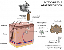 Аллергические реакции на татуировки: факторы возникновения